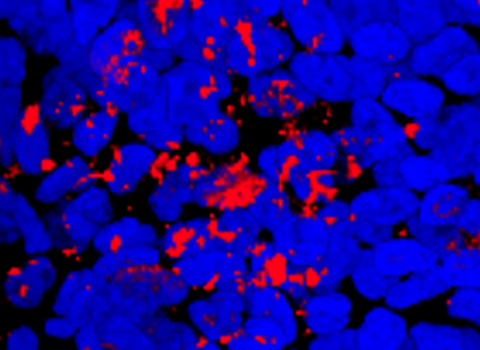 Photo de Nouvelle piste contre les infections bactériennes dans la mucoviscidose